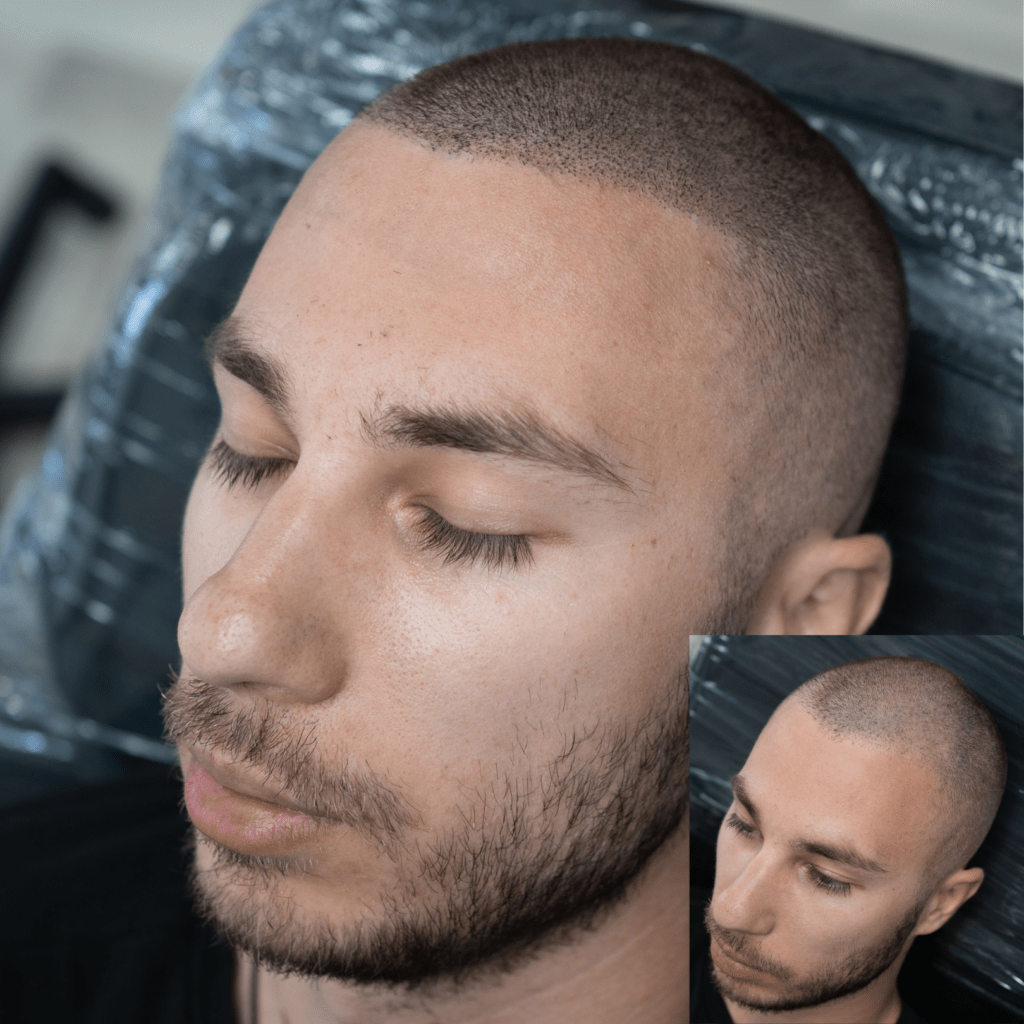 SMP Density AZ ScalpDoctor